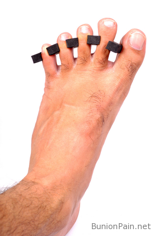 Bunion surgery recovery Bunion surgery recovery