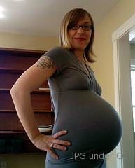 Appendicitis in pregnancy
