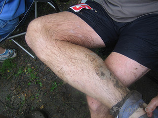 What Causes calf cramps